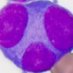 SAKUΛ(サクラ) (@mt_hematology) Twitter profile photo SAKUΛ(サクラ) (@mt_hematology) Twitter profile photo