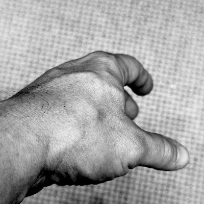 VascularHand Profile