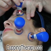 MassageCupping's profile picture. Sonia Morton is an instructor for the International  Cupping Therapy Association or ICTA. We teach classes, sell cups, Heal, etc.