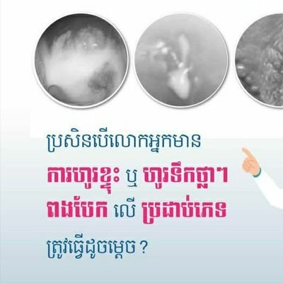 ផ្តល់ប្រឹក្សានិងធ្វើតេស្តឈាមរក មេរោគអេដស៍ កាមរោគ ស្វាយ ប្រមេះ ថ្លើម ពិនិត្យនិងព្យាបាលដោយឥតគិតថ្លៃ&ផ្តល់ប្រឹព(កាមរោគ សើស្បែក)Telegram: 087212436