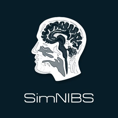 Open source software package for the Simulation of Non-invasive Brain Stimulation.