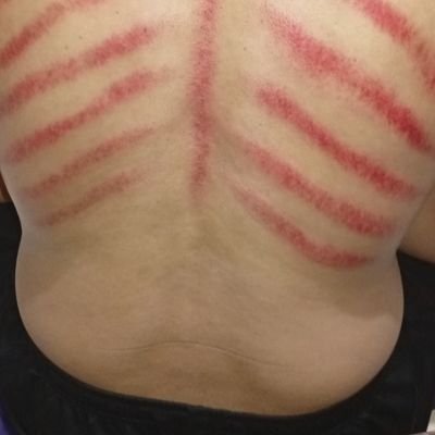YANA PIJAT BANDUNG
( X WAWAN ASGAR )
MENERIMA PIJAT PANGGILAN / DI TEMPAT
_FULLBODDY MSSAGES
_BEKAM
_KEROKAN
_CUKUR
LOKASI : KOTA BANDUNG
WA : 085722132659
