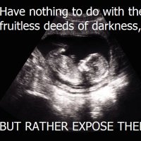 Total ABORTION Depravity (@abort_depravity) 's Twitter Profile Photo Total ABORTION Depravity (@abort_depravity) 's Twitter Profile Photo