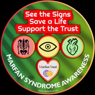 Marfan syndrome is an inherited disorder of the body's connective tissue that affects men and women of any race or ethnic group. Join Our forum for more info!