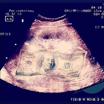 $UM
ultrasound money 🦇 🔊
https://t.co/kfzuj1aaaZ