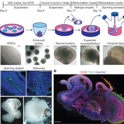 abrainorganoid's profile picture. Nom: Stan
16
Neuroscience and physics kid
https://t.co/Ai3ZHdy2Se
https://t.co/dGnwkSnKLR