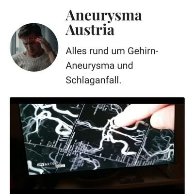 Meine Initiative ist-
erste Selbsthilfegruppe für Patienten mit Hirnaneurysma
und Schlaganfall in 🇦🇹 aufzubauen.
