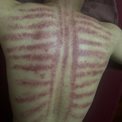 Hin60981888's profile picture. Nhật Bản tìm fwb ons