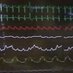 CardiacCritCare (@cardiac_crit) Twitter profile photo CardiacCritCare (@cardiac_crit) Twitter profile photo