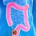 RAH Colorectal Research Group π« (@rahcolorectal) Twitter profile photo RAH Colorectal Research Group π« (@rahcolorectal) Twitter profile photo