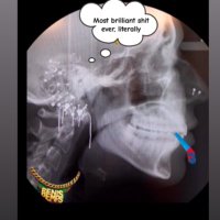 your second best dr. mid, md (@midphrenologist) 's Twitter Profile Photo your second best dr. mid, md (@midphrenologist) 's Twitter Profile Photo