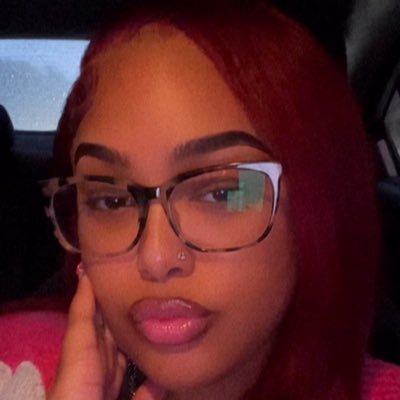 be yourself 😘 | ur fav esthi bae | 📸:lovelyjadore CEO of @whattheglamaesthetics