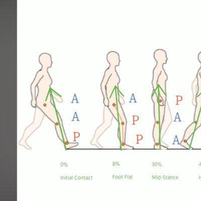 Po__Omar's profile picture. 🦿