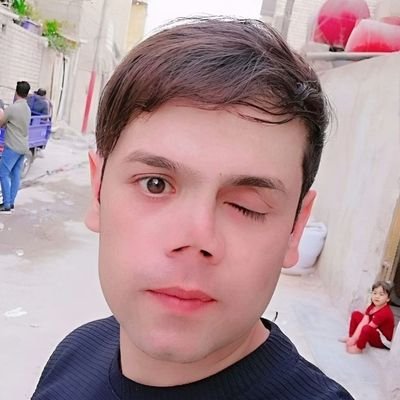 11 شـباط 2017 يومـها تركـت قنـبلة دخانـية اثـرها علـى وجـهي وهشـمته فـي سـاحة التـحرير ببـغداد