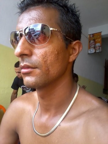 Sempre SDV