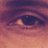 allen_cagn25129