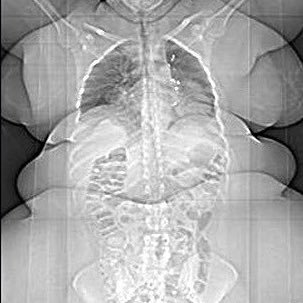 hedoneaphrodite's profile picture. just a 1.6m and 115kg bitch whining nonstop so fuck me and my thoughts