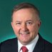 Anthony Albanese (@anthonyalb57) Twitter profile photo Anthony Albanese (@anthonyalb57) Twitter profile photo