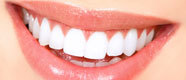 Tooth whitening จัดฟัน