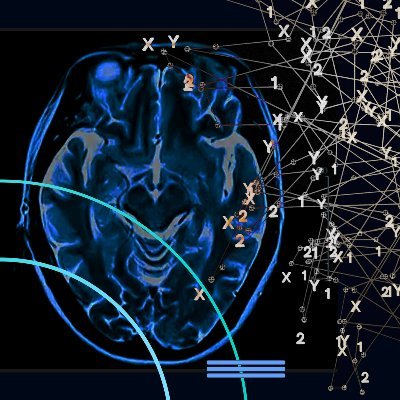 Antibodies for Alzheimer's Profile
