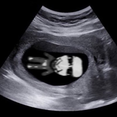 tlqkfqutls's profile picture. 