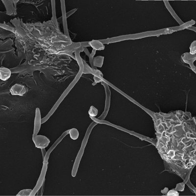 Perfil de la Unidad 1 del Departamento Microbiología y Parasitología de la @ffarmaciaUCM en @unicomplutense #Candida #Microbiota #Proteómica #Microbiología