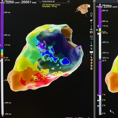 SWeishalla's profile picture. EP nerd (professional) @Abbottcardio