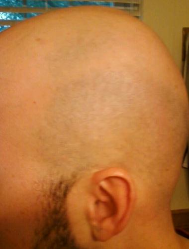 Baldy_Beardy's profile picture. Shampoo is the devil!