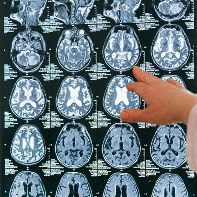 All things Radiology. Helping you prepare for the CORE, ABR, and more! Radiology news, AI, current research, recommendations, and guidelines for your practice