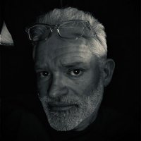 Dan Milner, MD. MSc(Epi), MBA (@damilnermd) 's Twitter Profile