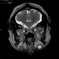 Neuro rads (@neuroradiology_) 's Twitter Profile Photo
