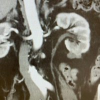 Dr B Kumar (@bkidneydoc) 's Twitter Profile