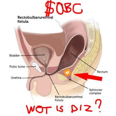 I find buttholes on X and in private.
CA: 2Wdkmp5krVcd5iXa5Y4dwU88ACnTAn96GGcPPwGhpump
