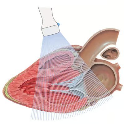 EchoXSphere's profile picture. Cardiology and Echocardiography database