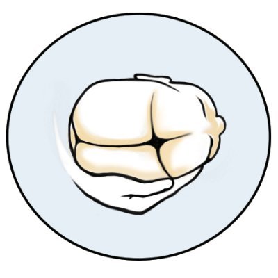 Screening for Craniosynostosis in Infants (SCI) is a UK based research group exploring early diagnosis of craniosynostosis