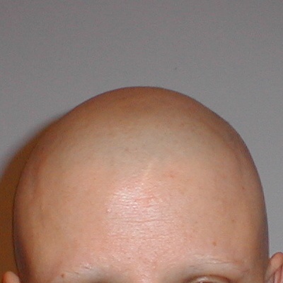 cancermama's profile picture. Originally diagnosed BRCA in 2004, NED for almost 5 years, Mom to a baby girl, getting my house in order before I go.