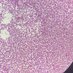 NEW ACCOUNT, ADD OLD OOMF RN Staphyloccus Aureus (@aureus_coccus) Twitter profile photo NEW ACCOUNT, ADD OLD OOMF RN Staphyloccus Aureus (@aureus_coccus) Twitter profile photo