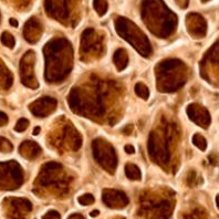 OsteoporosisMX's profile picture. Blog centrado en la enfermedad de osteoporosis. Compartimos información, imágenes, estudios, noticias, tips y comentarios sobre la osteoporosis.