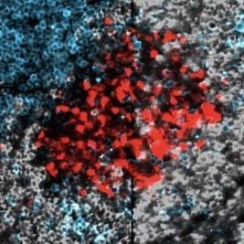 GC-matured PB-PCs مهتمه بالمراكز الجرثومية المكونة للأجسام المُضادة/Immunotherapy العلاج المناعي/الهدف تعليمي اكاديمي وبحثي /في شرحٍ مُصاغ باللغة العربية