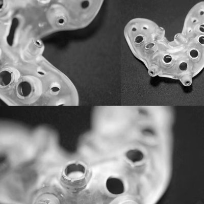 Hi, I'm Linsen,
a seasoned dental designer with 15+ years perfecting digital smile design. I specialize in precision-driven crow.https://t.co/Hbg98ywAtf