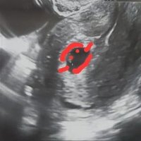 Ultra Baby Grok( close) (@ultrababygrok) 's Twitter Profile