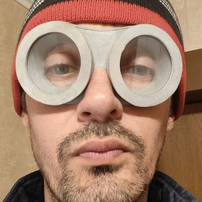 Help fix the face. I want to be happy and not sad when I look at my face! My BTC and ETH address under