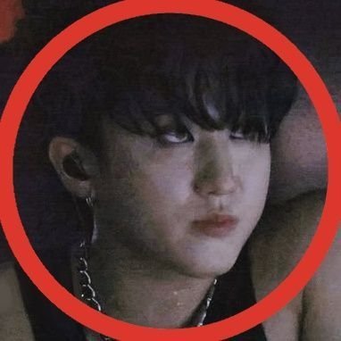 only skz | Please, help my kitty Aki with her healing process 🐾🩹: https://t.co/euORcedZSx