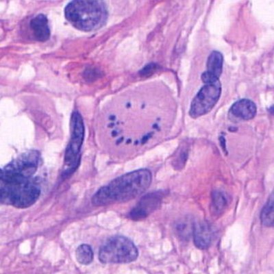 Surgical Pathology Cases Profile