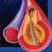 Endovascular Therapy (@jendovasculart) Twitter profile photo Endovascular Therapy (@jendovasculart) Twitter profile photo