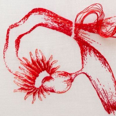 CCENDOMETRIOSIS's profile picture. Cuenta creada puntualmente para la divulgación de información sobre la endometriosis dentro del marco de la asignatura Content Curation de la UOC