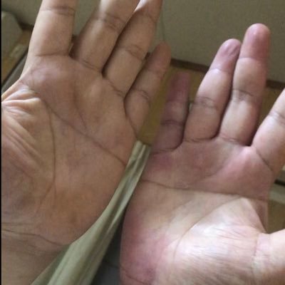 自分両手マスかけ線なんですけど なんかないかな?かなり運ええんやけど 自分て言うんなやけどコレマジです 詐欺師じゃありません なんかビジネスしませんか?成功しか思いつかないです。 Redspider SINGO☆西成