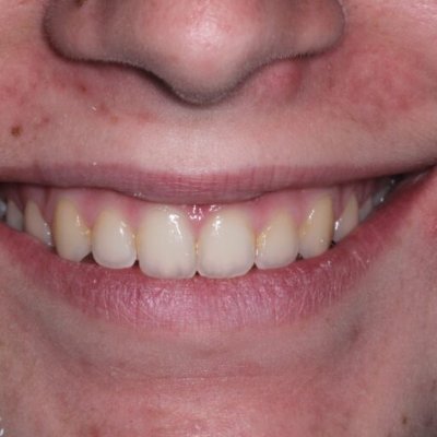 CeliaLp96929126's profile picture. Ex actriz porno decepcionada de los puñeteros políticos rojos y los pendrives.  Me late la pinche política hispana.