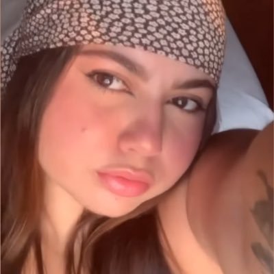 Me exponho aqui pra vocês verem que gente bonita também sofre