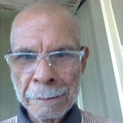 BlondellDi88435's profile picture. Soy ING y profesor universitario, Necesito un MARCAPASO URGENTE (BATERÍA MENOS de 5 meses). Contacto al DM